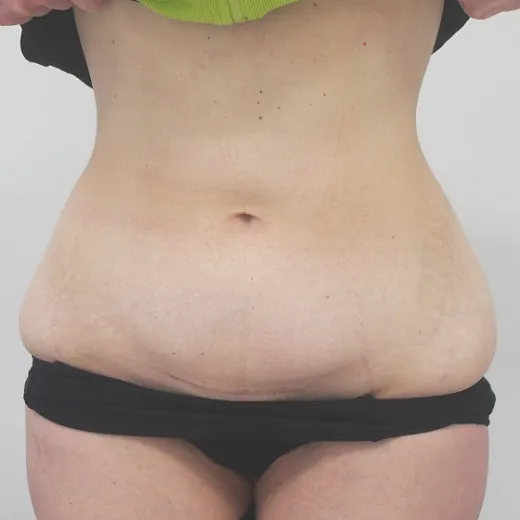 Image before