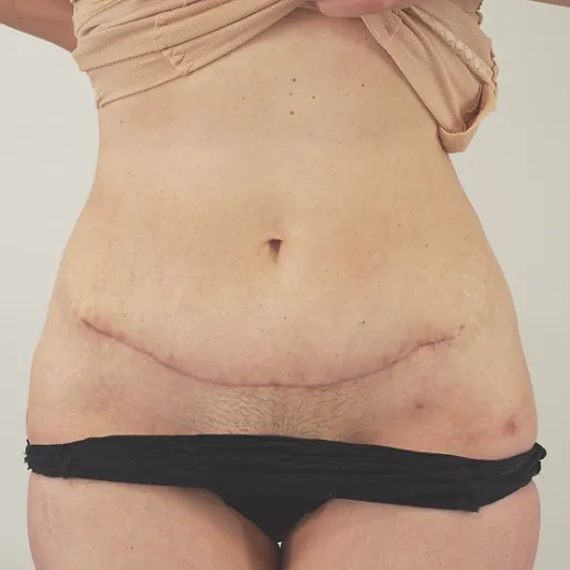 Image after
