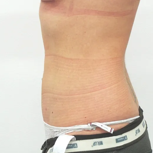 Image after