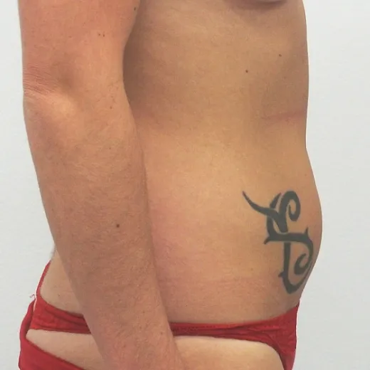 Image before