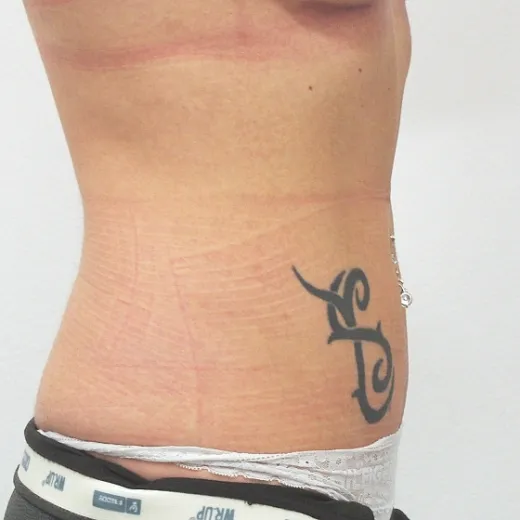 Image after