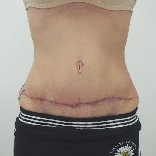 Image after