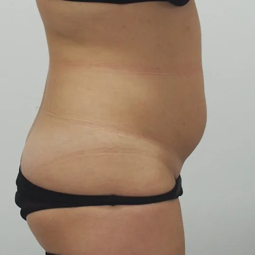 Image before