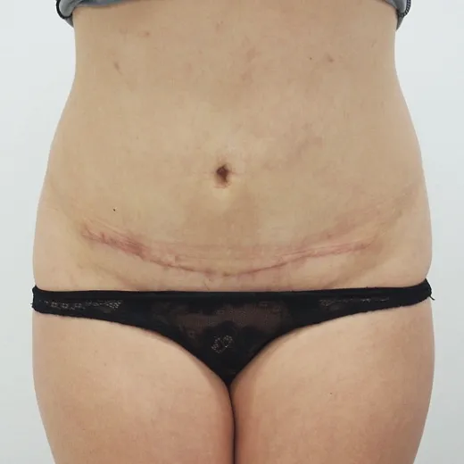 Image after