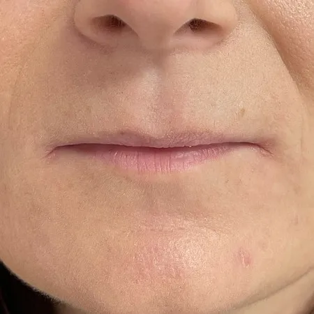 Image before