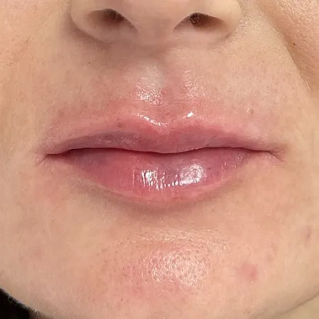 Image after