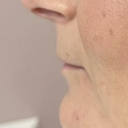 Image before