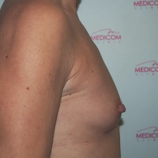 Image before