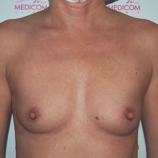 Image before