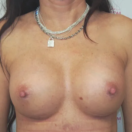 Image after