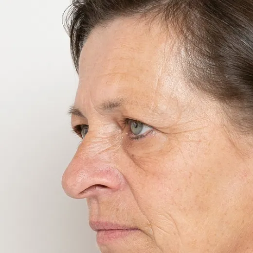 Image before
