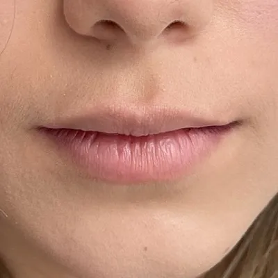 Image before