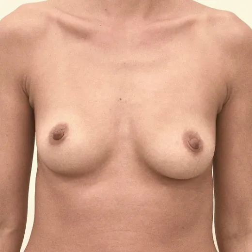 Image before