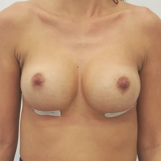 Image after