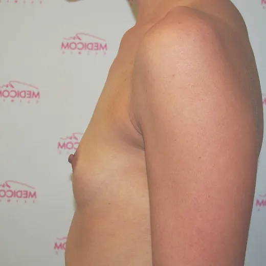 Image before