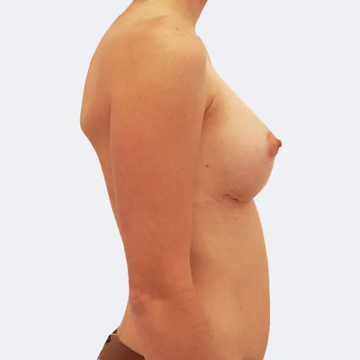Image after