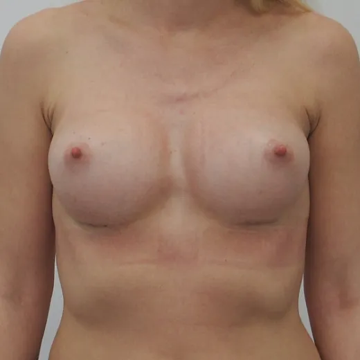 Image after