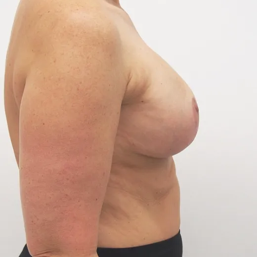 Image after