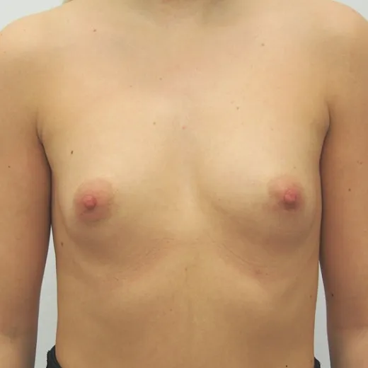 Image before