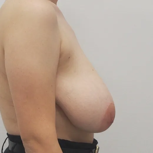 Image before