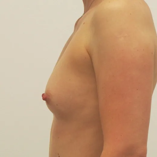 Image before
