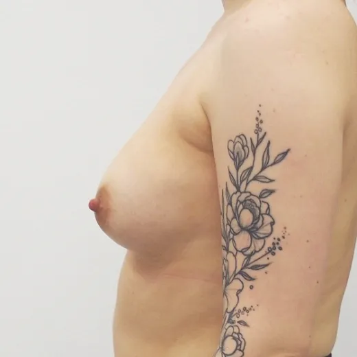 Image before