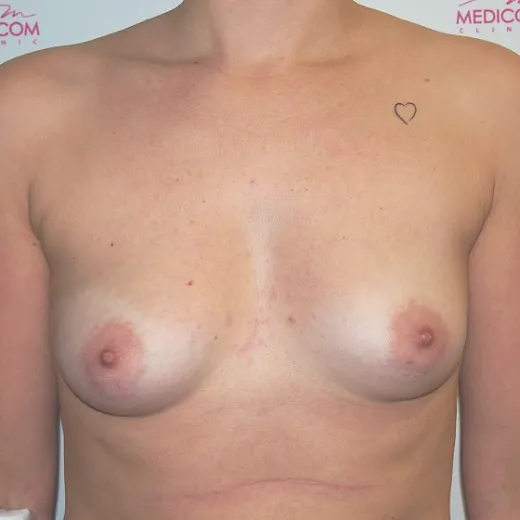 Image before
