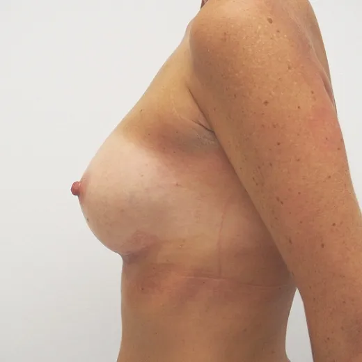 Image after
