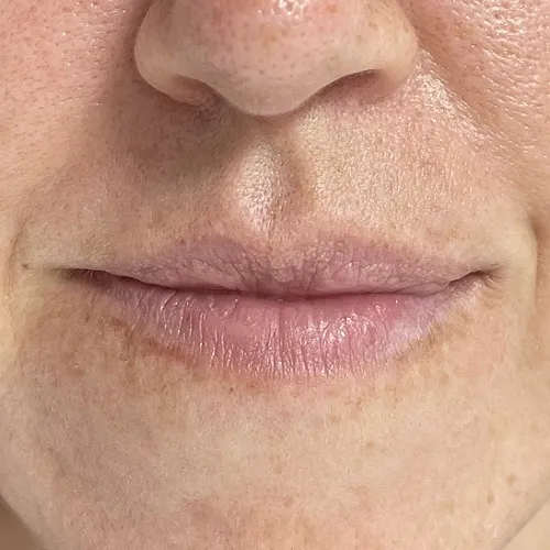 Image before