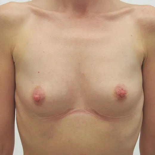 Image before