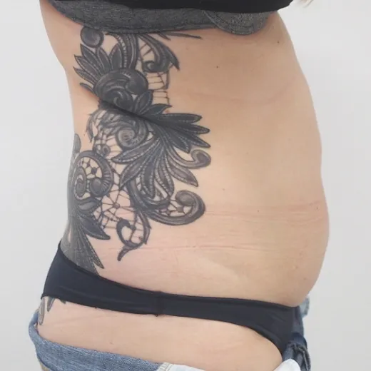 Image before