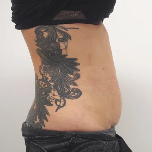 Image after