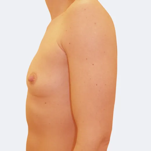 Image before