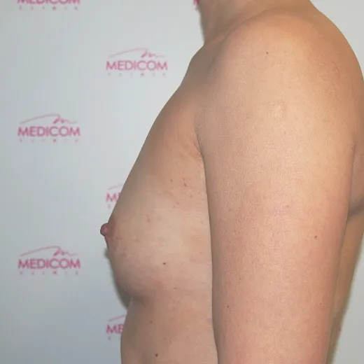 Image before
