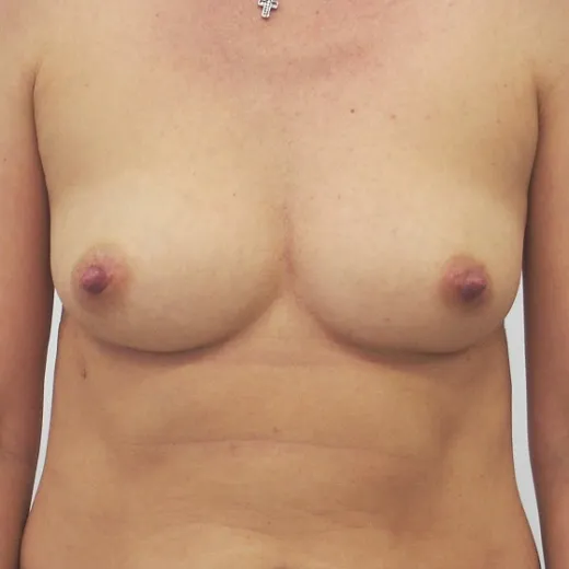 Image before