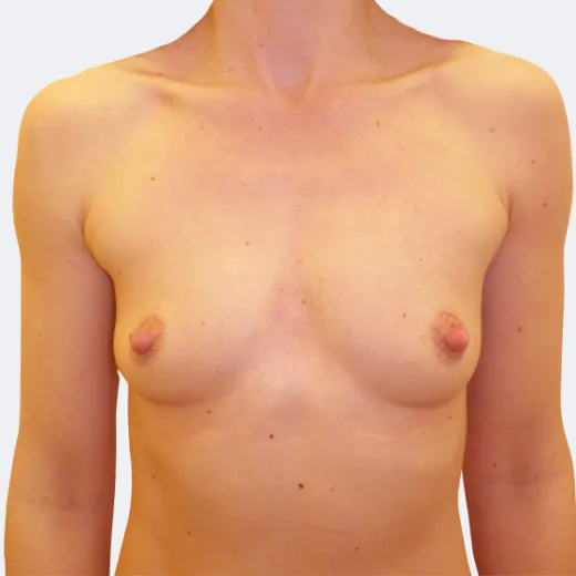 Image before