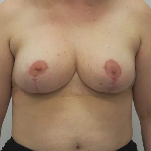 Image after