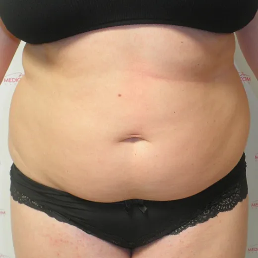 Image before