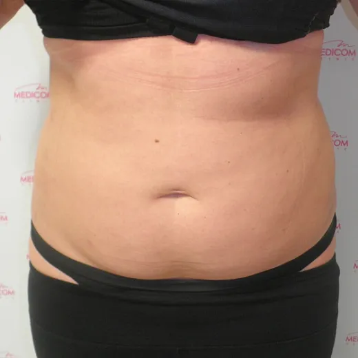 Image after