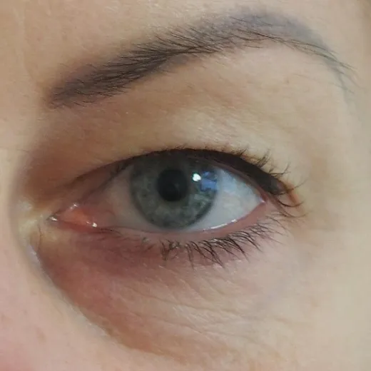Image before