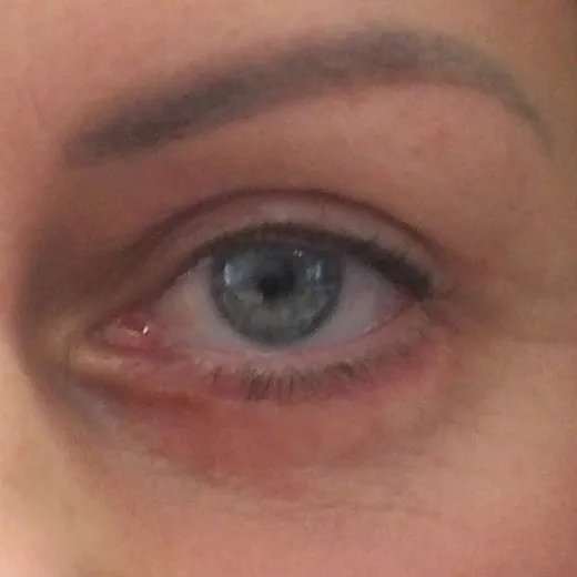 Image after