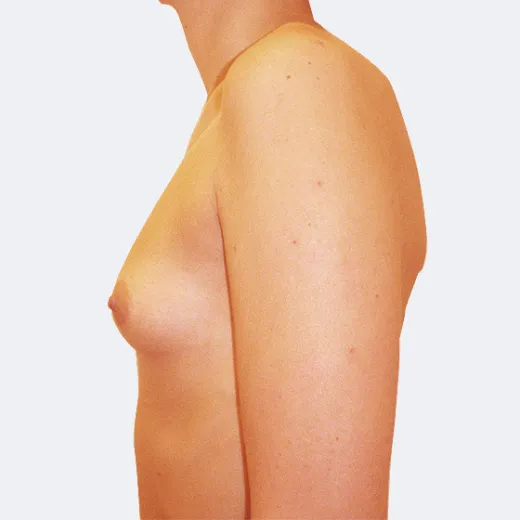 Image before