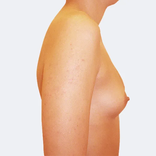 Image before