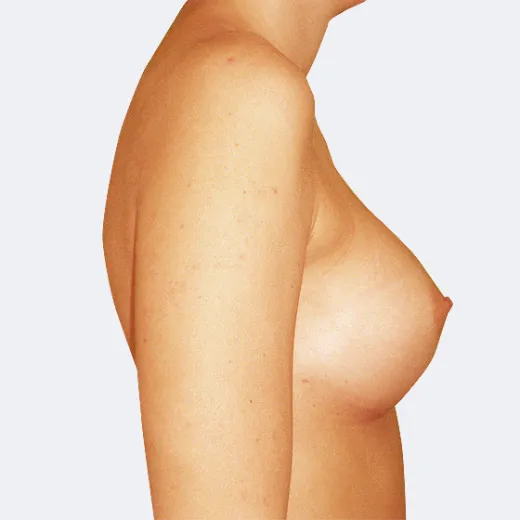 Image after
