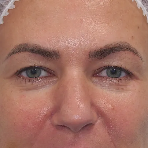 Image before
