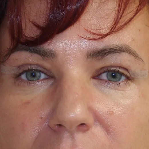 Image after