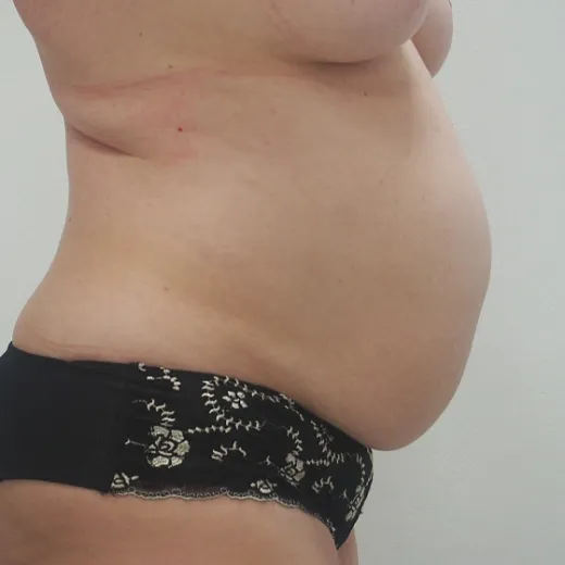 Image before