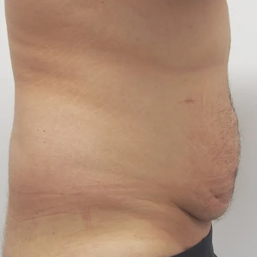 Image before