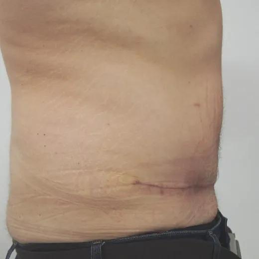 Image after