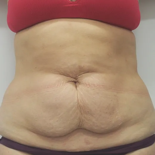 Image before